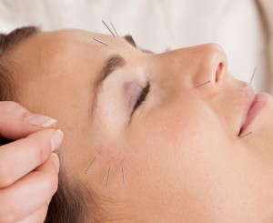 Acupuncture with Elaine Geary
